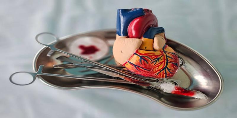The Role of Organ Matching in Ensuring Transplant Success